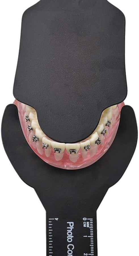 RZJZGZ (6Pcs) Dental Photo Contrast Black Background Board, Autoclavable Dental Orthodontic Oral Cheek Retractors