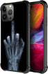 ZHEGAILIAN Skull Hand X-ray Case for iPhone 15 Pro Max, 6.7", Soft TPU Bumper, UNBreak Reinforced Corners, Men/Boys.