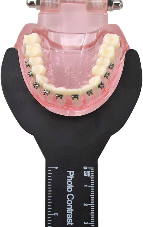 RZJZGZ (6Pcs) Dental Photo Contrast Black Background Board, Autoclavable Dental Orthodontic Oral Cheek Retractors