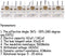 Acxico 5Pcs 223p Duplex Radio Variable Capacitor - 60pf/140pf 2.1mm Hole Shaft for Pocket Radio Accessories