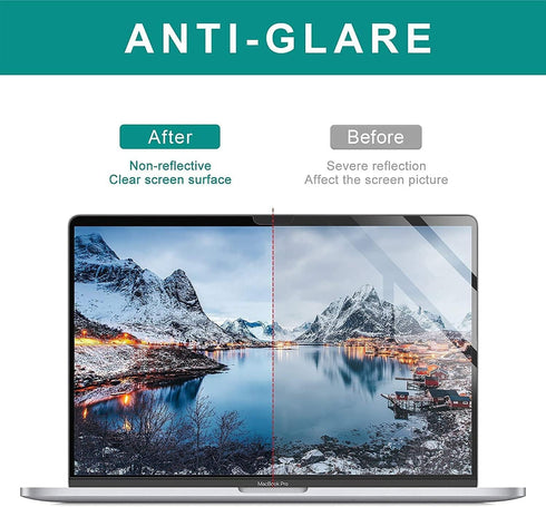 ZOEGAA MacBook Pro 14 Inch Screen Protector 2021-2024, Eye Care Anti Blue Light & Anti Glare, Compatible with MacBook
