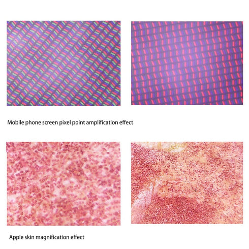 Skin Analyzer Hair Scalp Detector, 800X Magnification Portable USB Microscope with 8 Light Chips for Skin and Hair